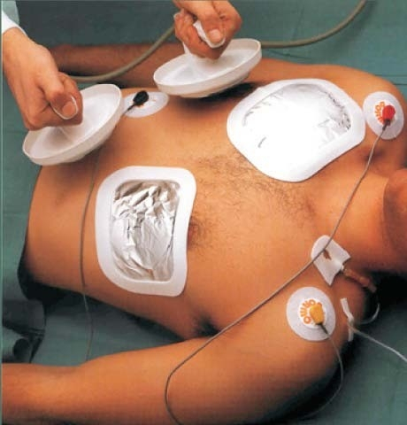 50 pad desfibrilador (conjunto de 2)